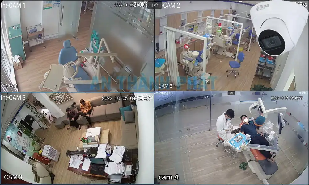 lap-dat-camera-nha-khoa